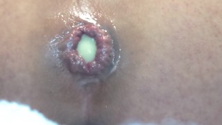 アナルに卵を入れて拡張